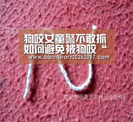 狗咬女童警不敢抓如何避免被狗咬“BBIN直播”(图4) BBIN体育